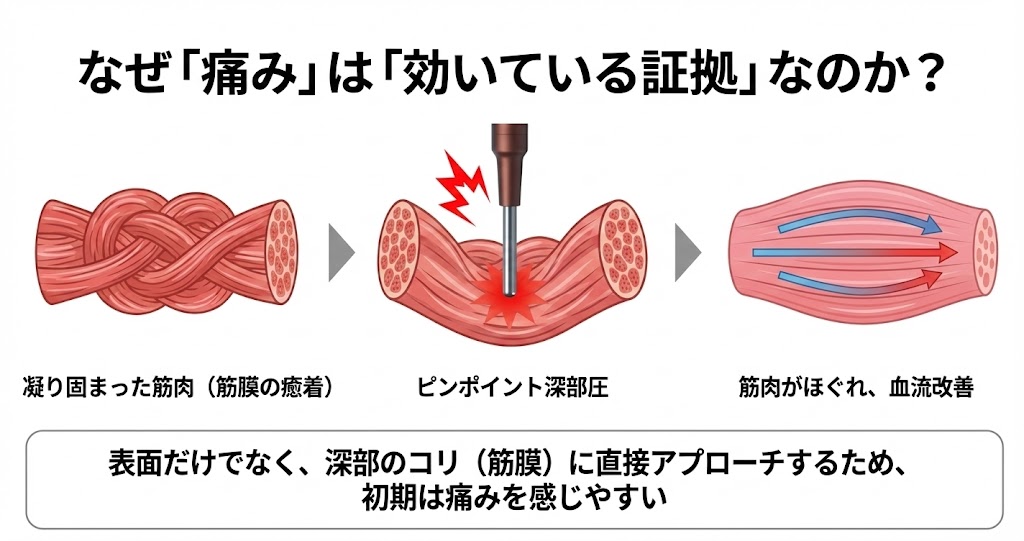 コアフィットフェイスポインター「痛み」は「効いている証拠」なのか？